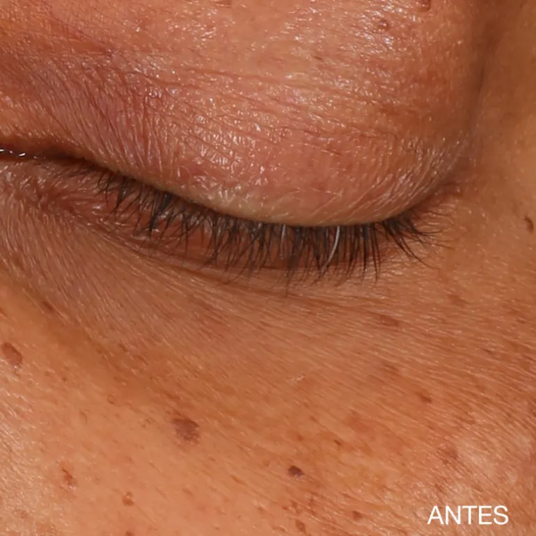 All About Eyes Brightening Serum