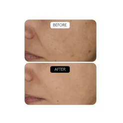 Clinical Beauty Filler
