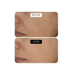 Clinical Beauty Filler Duo