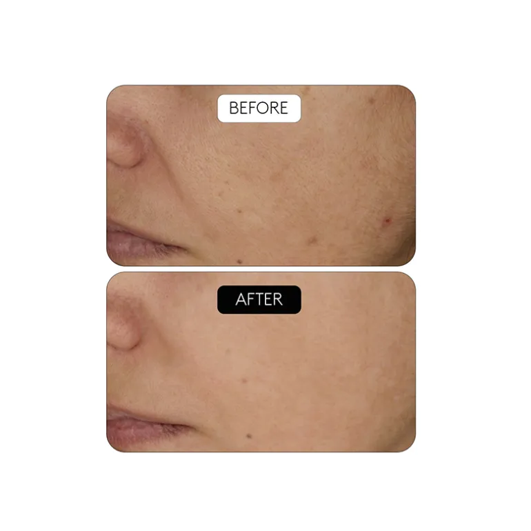 Clinical Beauty Filler Duo