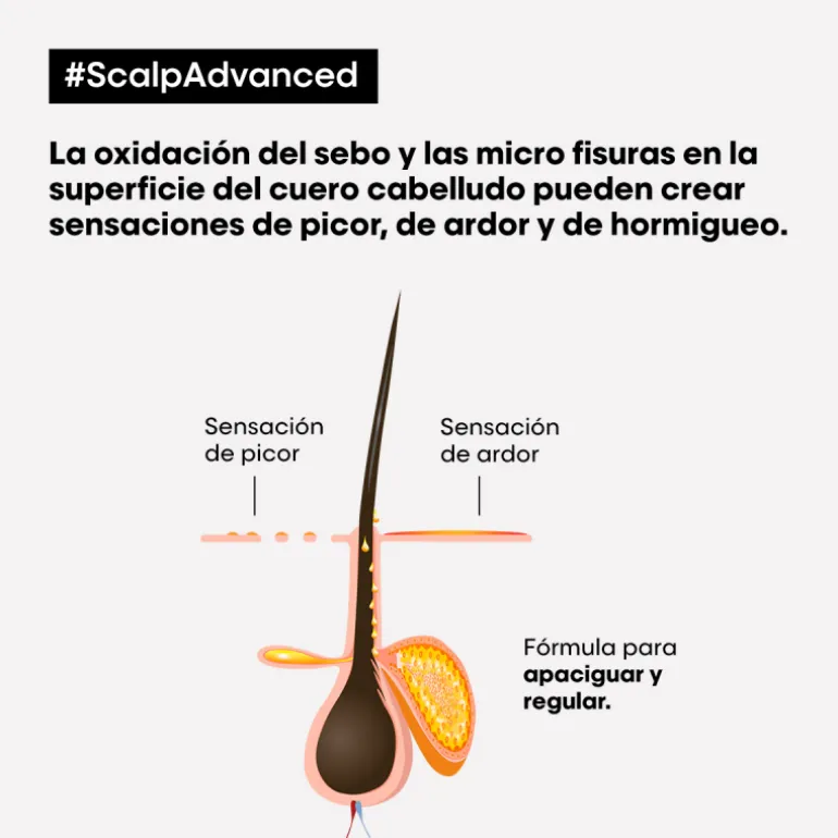 SCALP ADVANCED ANTI-DISCOMFORT CONDITIONER